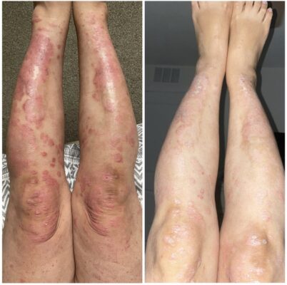 powercurc30 before and after